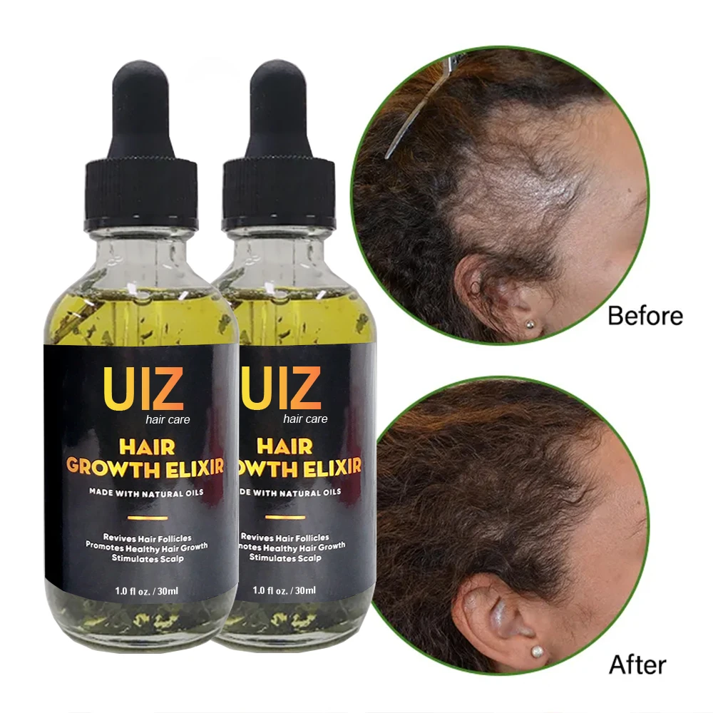 Hair Growth Serum natural essential oils and plant extracts healthy stimulate hair follicles grow Growth Hair Elixir