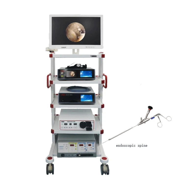 shrek endoscope manufacturers osteoscopy tower system