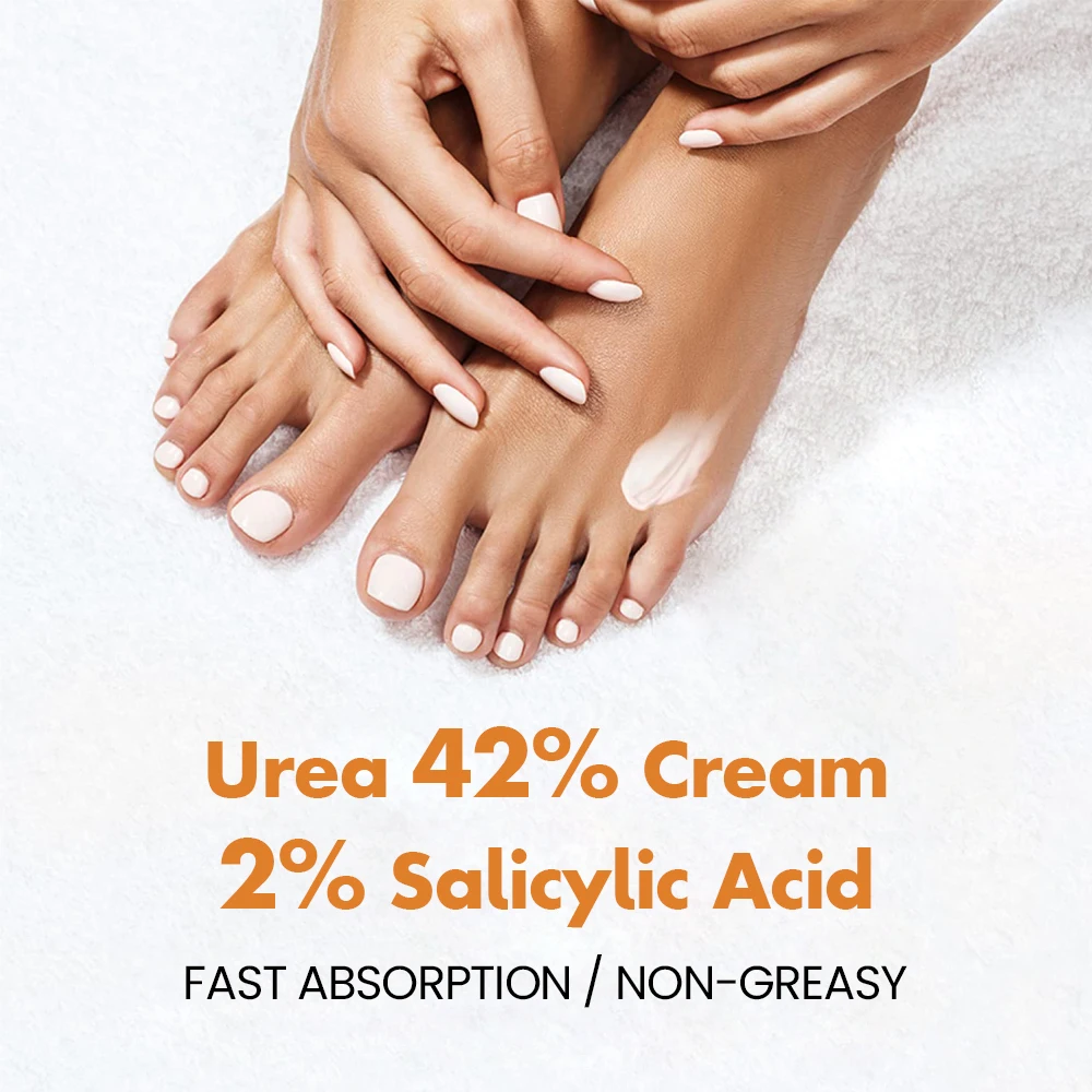 Best 42% Urea 2% Salicylic Acid Dry Cracked Heel Remover Urea Foot Cream Dead Skin Removal Cracked Heels Foot Cream