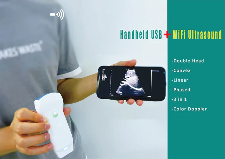 ultrasound scan machine with all the probes portable ultrasound with vascular and echo probe