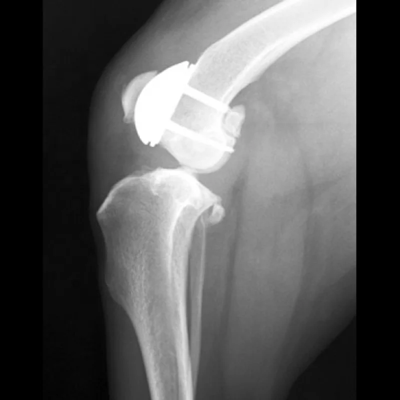 Runphy Professional Veterinary Knee replacement Vet Patellar Groove Replacement Surgery Implanted Prosthesis Titanium Groove P