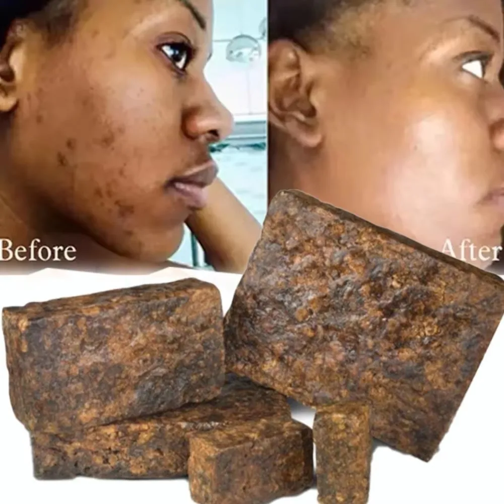 Specialty Organic African Black Soap Acne & Dark Spots Dry Skin Treatment Pimples Blackhead Handmade Soap for face & body