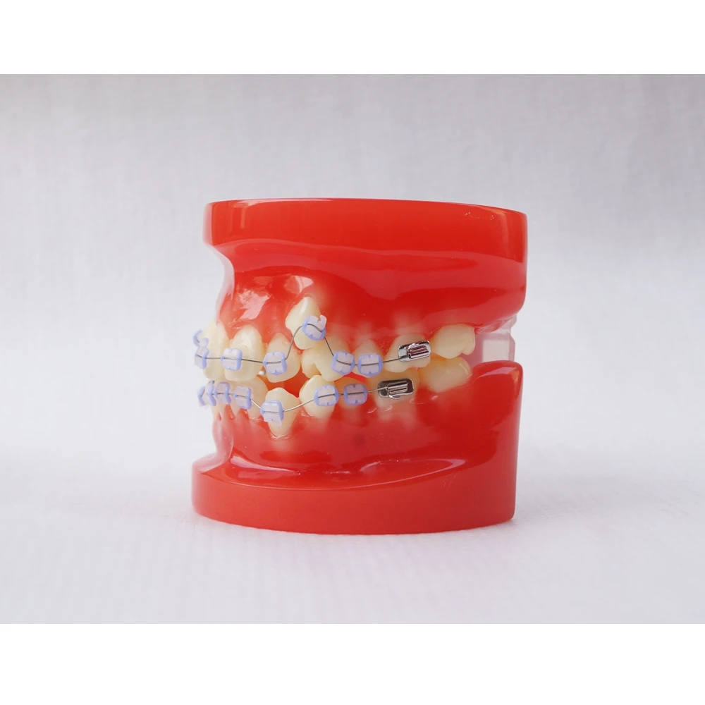 Dental Orthodontic Teeth Study Model 28 Teeth with Ceramic Bracket
