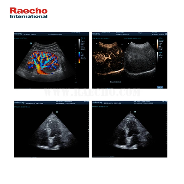 Mindray Optical Electronic Trolley Diagnostic Ultrasound Machine