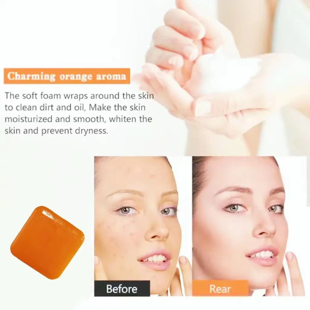 Hot selling best price brightening soap bar dark spot remover handmade 100% natural body and face kojic acid soap