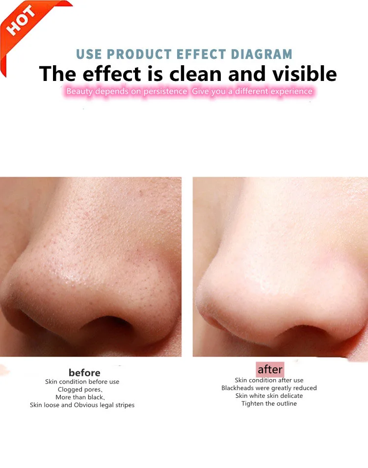 Professional face exfoliating device deep cleansing Electric ultrasonic facial skin scrubber