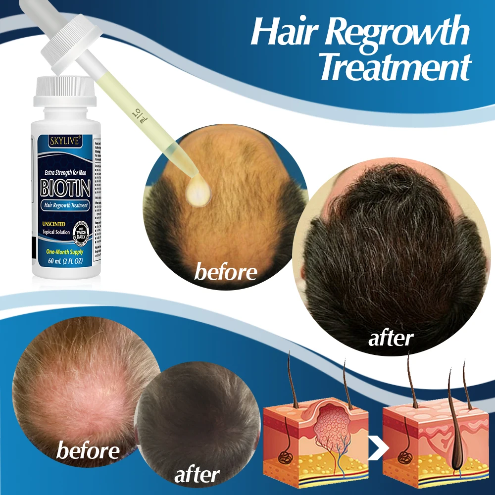 Biotin Hair Growth Serum For Anti Loss Essential Oil Products Fast Treatment Prevent Thinning Dry Frizzy Repair Private Label