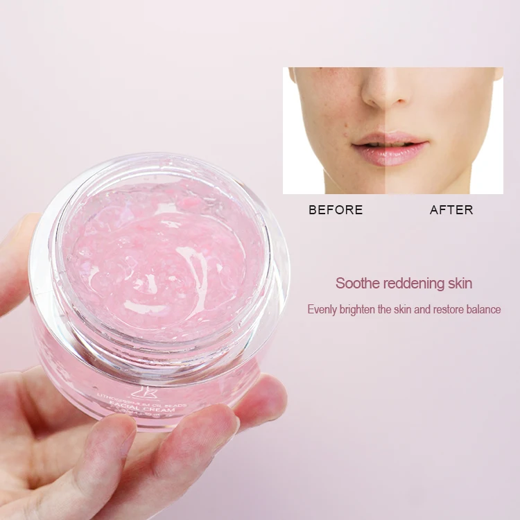 Organic Herbal Tea Tree Repair Freckle And Acne Spot Remover Cream Oil Control Anti Acne Blemish Remove Dark Spot Face Cream