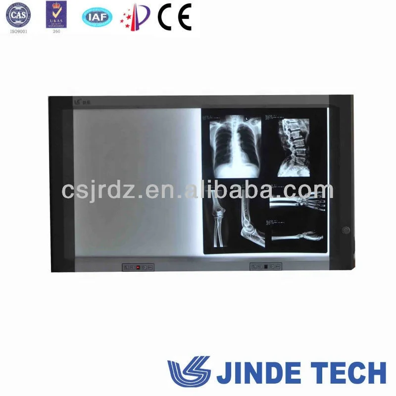 super thin high quality LED Medical view box,medical negatoscope film viewer,led view box and x ray film view box