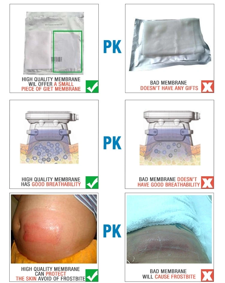 Antifreezing Membrane Etg Iii For Cryolipolyse Slimming Machine Membrane