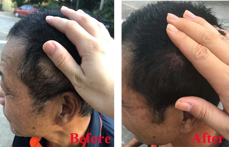 
Factory Price Free Samples Fast Color Herbal Dye Shampoo for White Hair to Black 