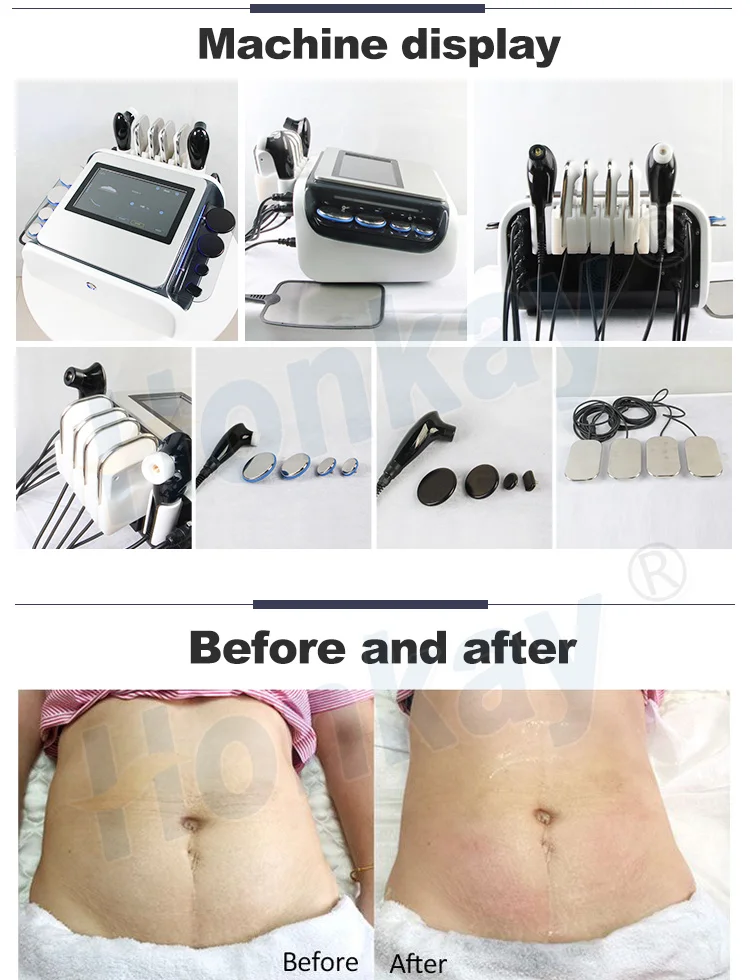 Tecar Radio Frequency Rf 448k Radiofrequency 448khz Facial Lifting Fat Reduction Rf Slimming Beauty Machine