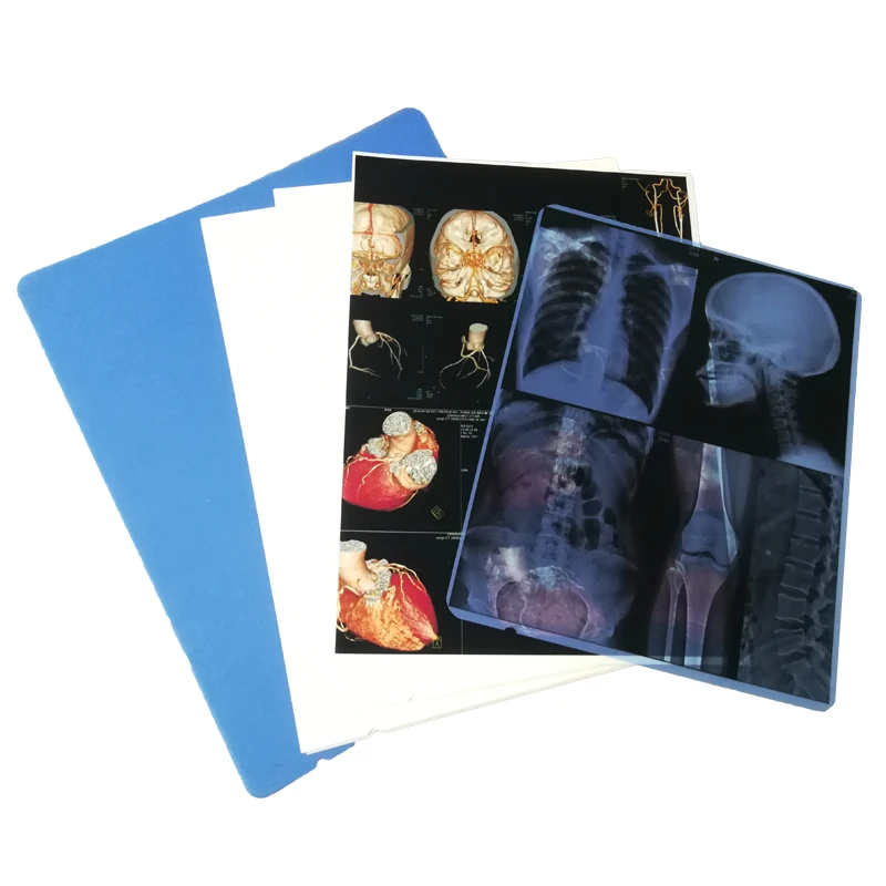 Дешевая струйная ПЭТ синяя рентгеновская пленка для принтеров Canon Pixma