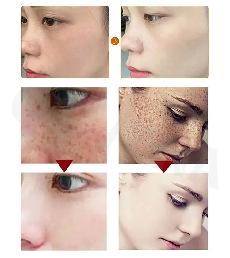 Copper peptide Retinol vitamin C E hyaluronic acid anti aging wrinkle Cream