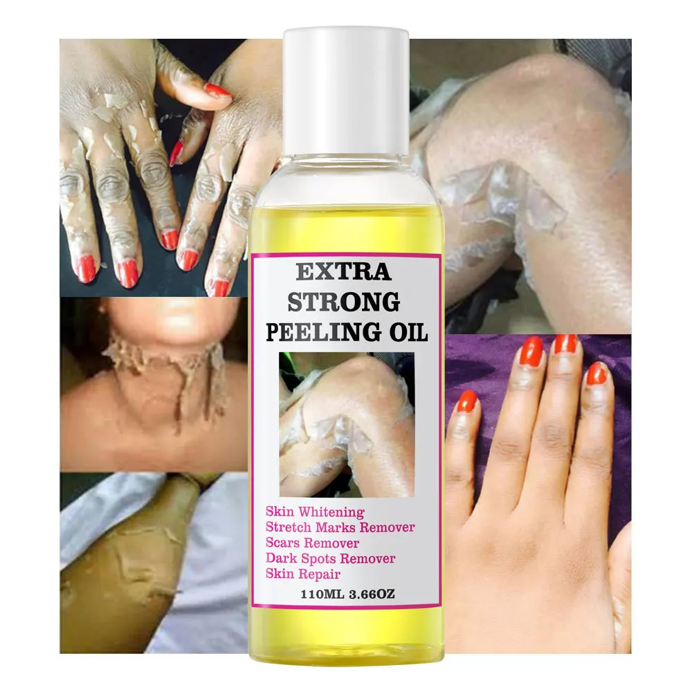 Factory Hot Selling Body Care Dark knuckle Scars Extra Strong Brightening Peeling Oil Dark Spots Remover Yellow Peeling Oil