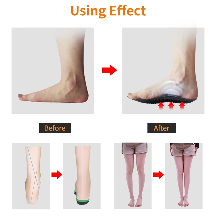 Best price havainas arch support flip flops Correct arch orthotic flip flop slippers