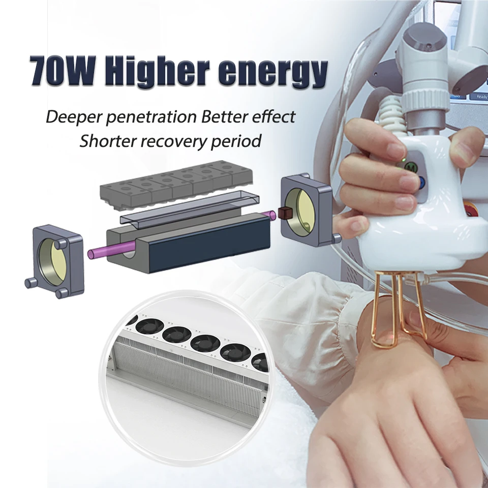 Winkonlaser Rf Tube фракционный Co2 лазер косметическая машина для шлифовки кожи