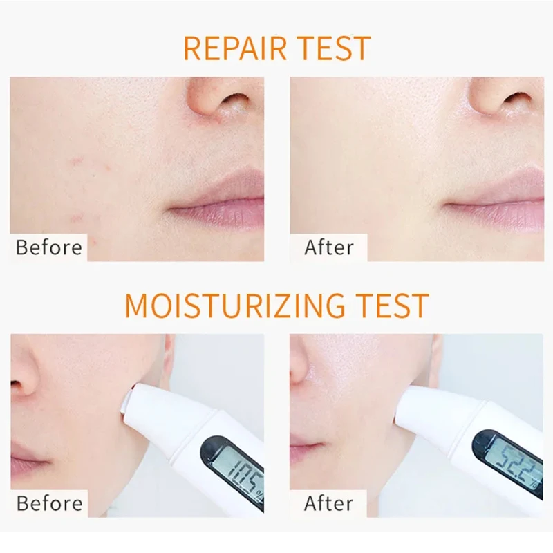 Antiaging Dark Spot Remover Acne Treatment Vitamin C Turmeric Cream Face Moisturising Cream Organics Skin Whitening Cream