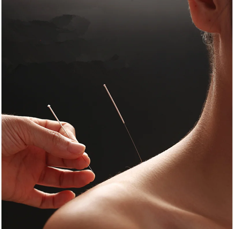 High Quality Hwato Acupuncture Needle 100 Copper Handle Disposable Chinese Sterile Acupuncture Needles Massage Needle