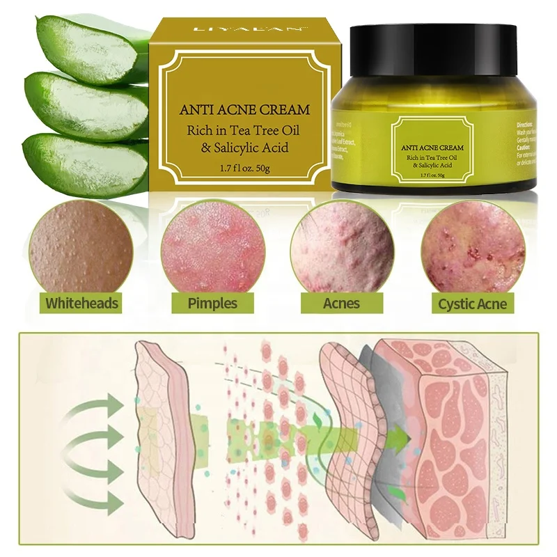 Tea Tree Oil Control Shrink Pores Acne Nourish Whitening Skin Care Face Cream