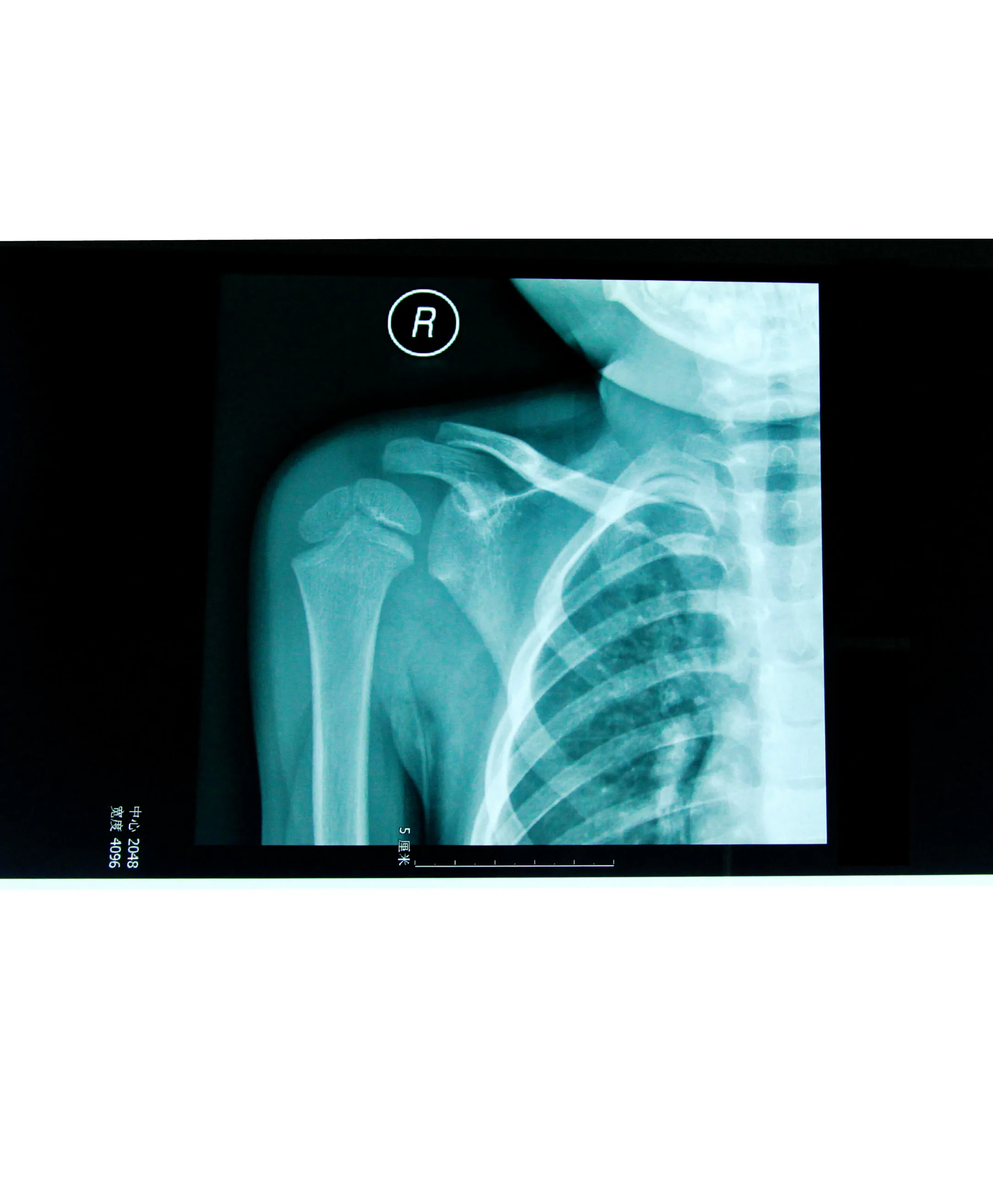 Hot selling x ray blue film for medical imaging FUJI AGFA x ray printer