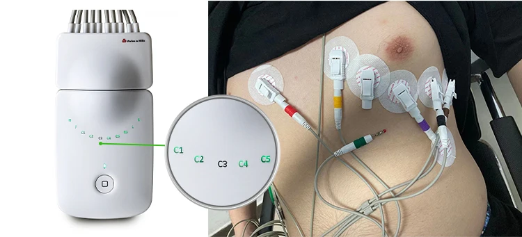 2024 New Year Chinese Manufacturer Medical Machine Portable Rest test ECG Machine With Pathological Analysis Equipments Software