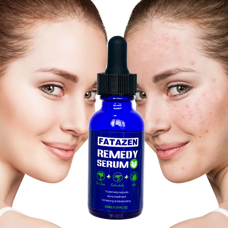 Private Label Natural Organic Anti-Inflammatory Anti-Aging Remedy Serum Skin Care Facial Serum Hydration Brightening Face Serum