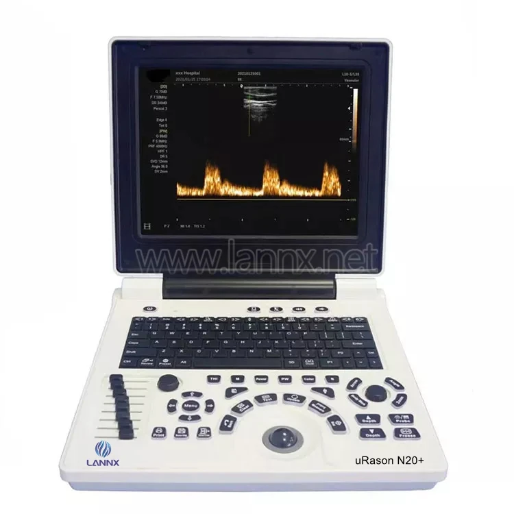 Lannx uRason N20+ Factory Ultrasound Instruments ecografia portatil Hospital Clinic 3d ultrasound Scanner for Human ultrasonic