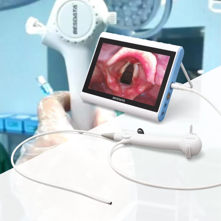 RhinoLaryngoscope Bronchoscope BESDATA surgical instrument 4k usb endoscope camera for ent endoscopy surgery with screen