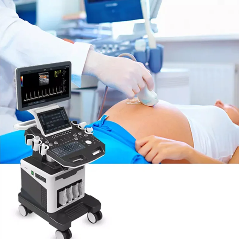 Digital 3D 4D color doppler portable medical ultrasound machine price