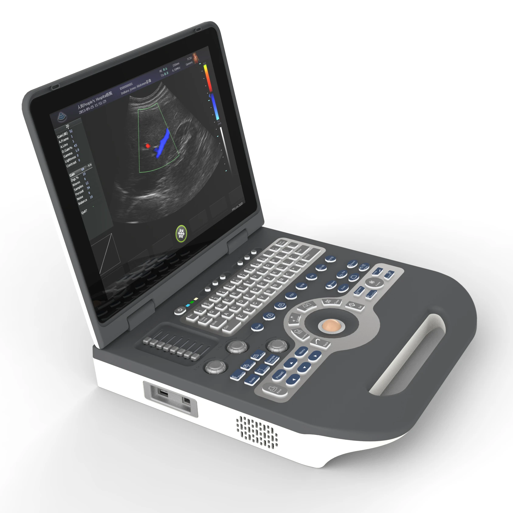 Full Digital Ultrasound Diagnostic System Notebook  portable Color Doppler Ultrasound Scanner 3D ultrasound machine