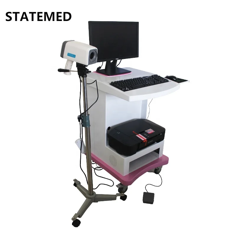 Hot selling mini digital colposcope for gynecology