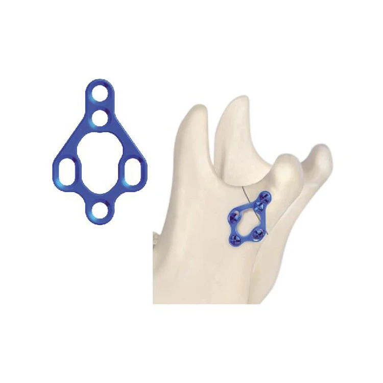 Orthopedic Titanium Maxillofacial Plate