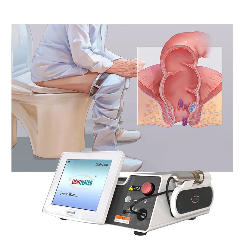 980nm 1470nm Proctology Hemorrhoids Therapy Machine Hemorrhoids Fistula Laser Surgery Germany Urology Fistula Rectal Proctology