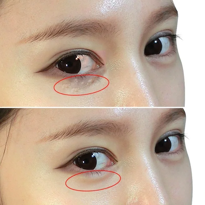 Skin Care eye bags removal under Eye firming tightening care cream for dark circles and puffiness