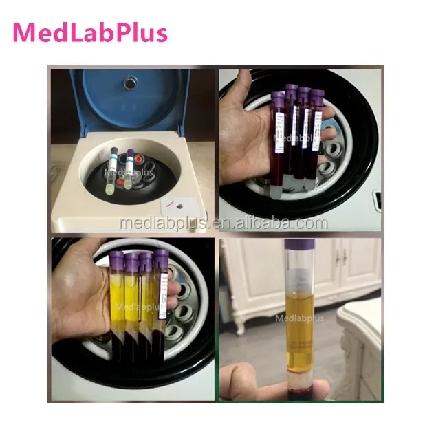 2023 PRP laboratory PRP centrifuge 15ml tube with ACD and Gel centrifuge prp tube