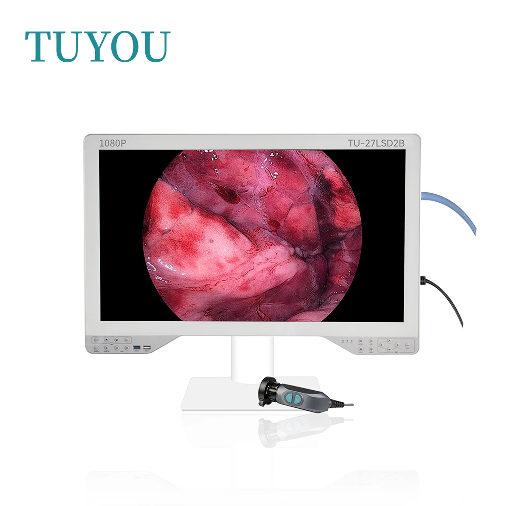 HD 27-Inch Laparoscopic Medical Endoscope Camera Grade Monitor with Video Recorder Fiber Optic Light Source All in One