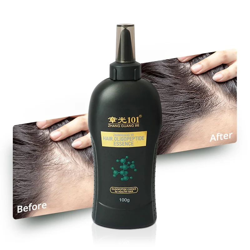 Oligopeptide Ginseng Extracts Organic Hair Growth Treatment Oil