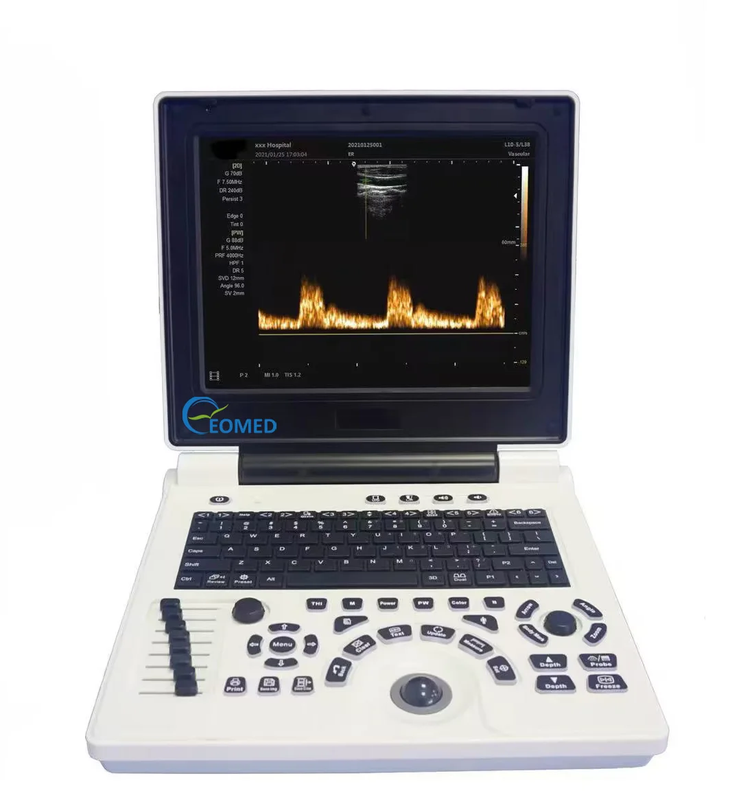 BW20 Medical Full digital ultrasound scanner ultrasound diagnostic machine with 12 inches LCD display