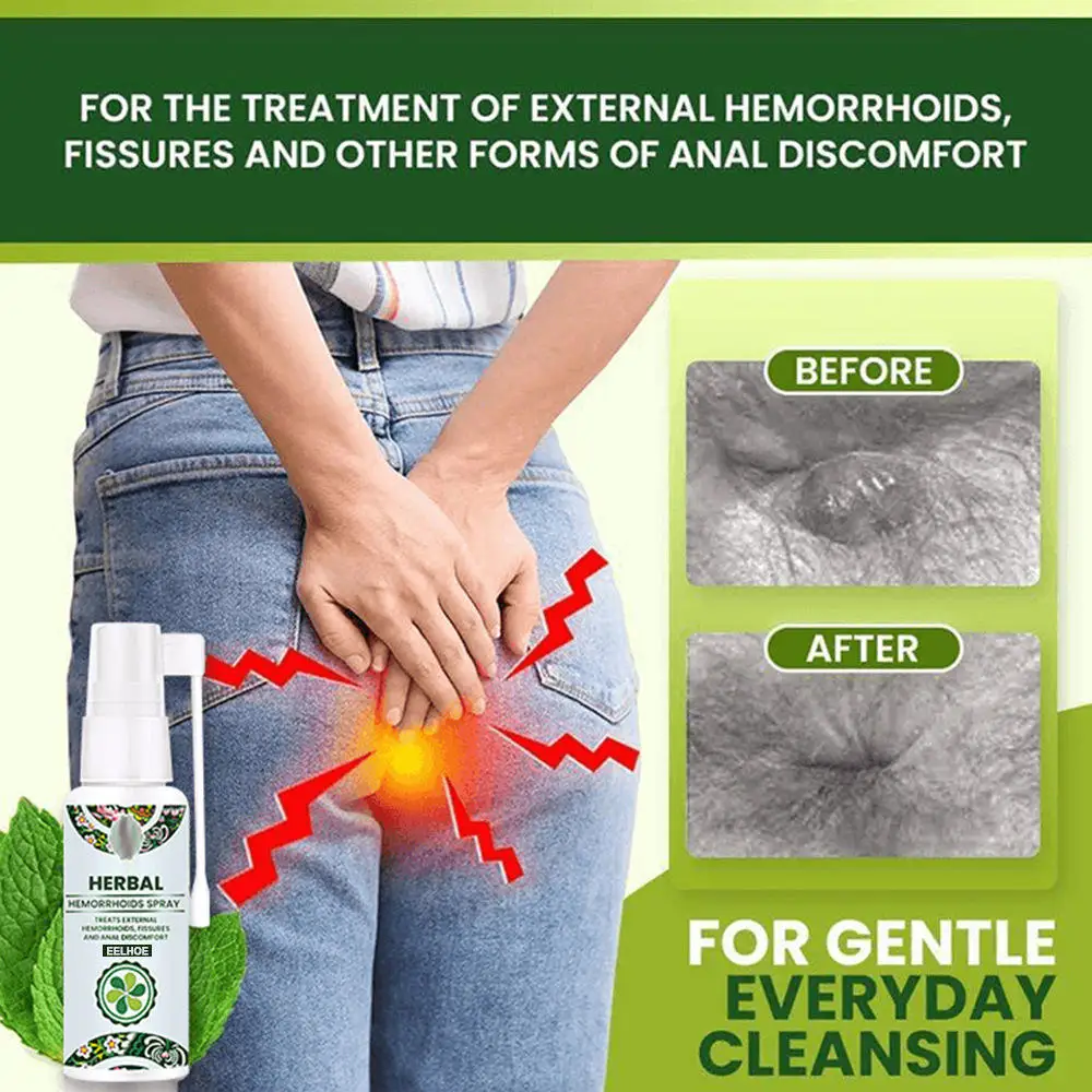 Hot Herbal Hot selling Natural Hemorrhoids Spray Powerful Hemorrhoids Treatment Agent Relieve Anal Pain Hemorrhoids Spray