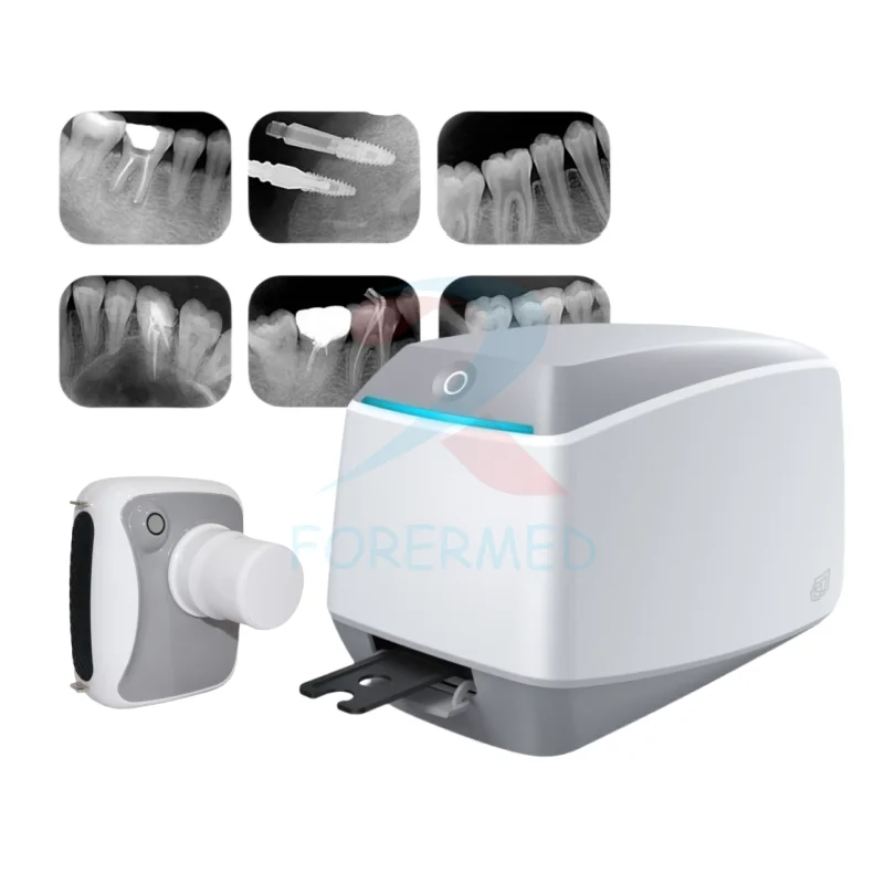 Smart Digital Dental Image Plate Scanner With SP-dot Matrix Super Pulse Laser Lattice Scanning Technology