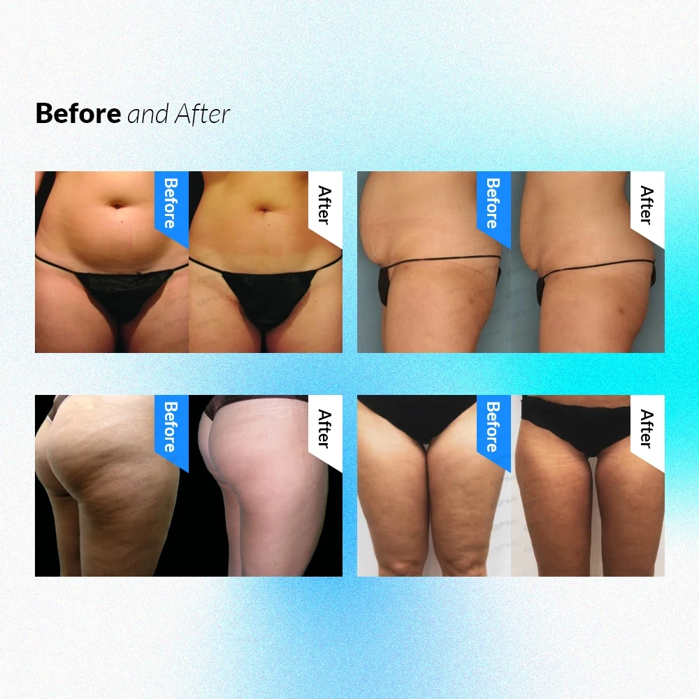 Hot sale cellulite shape fat burning equipment vela roller vacuum cavitation rf shape v9 machine with 4 handles