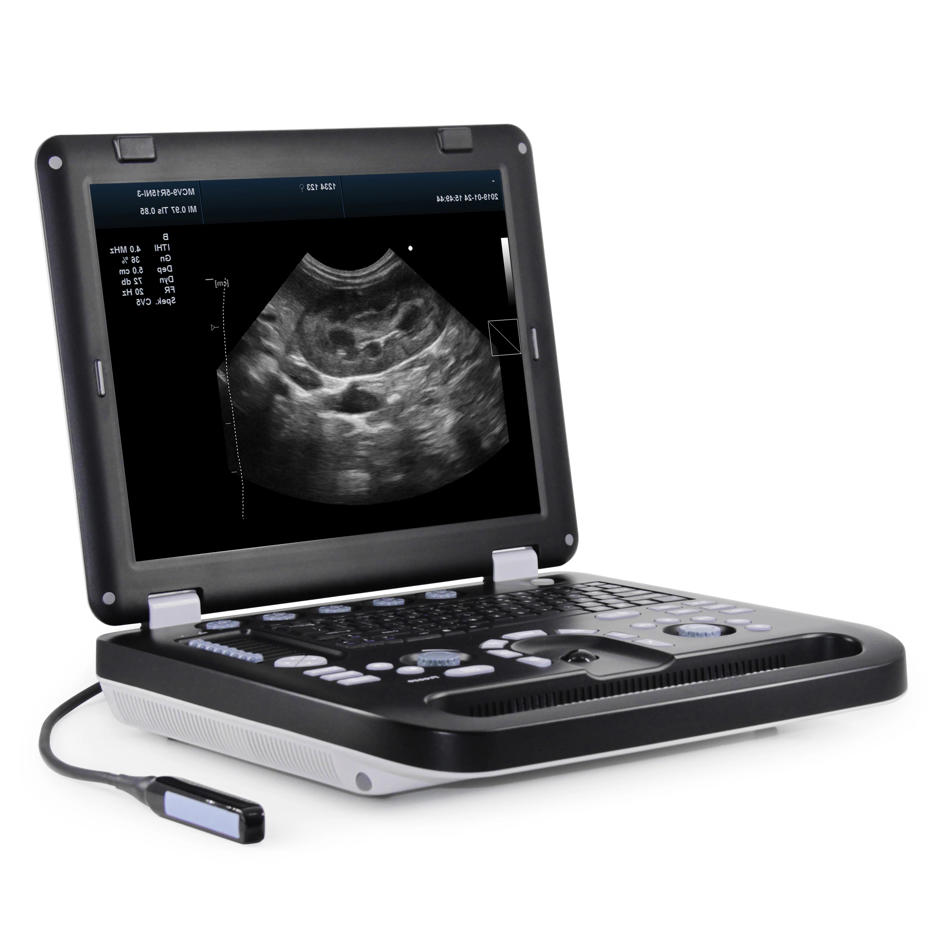 Clinic Hospital Medical Sonography Machine USB Wireless Full Digital B Mode 3D 4D Obstetric Doppler Human Ultrasound Scanner