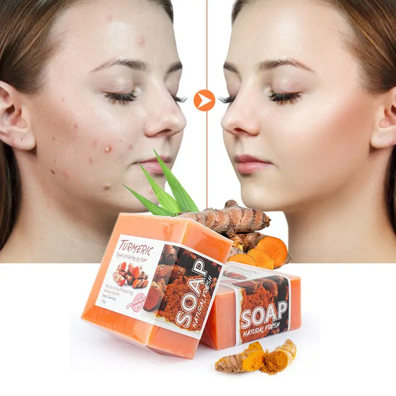 Wholesale Skin Care Shower Bath Soap Bar Skin Lightening Anti Acne Deep Cleansing Natural Turmeric Soap