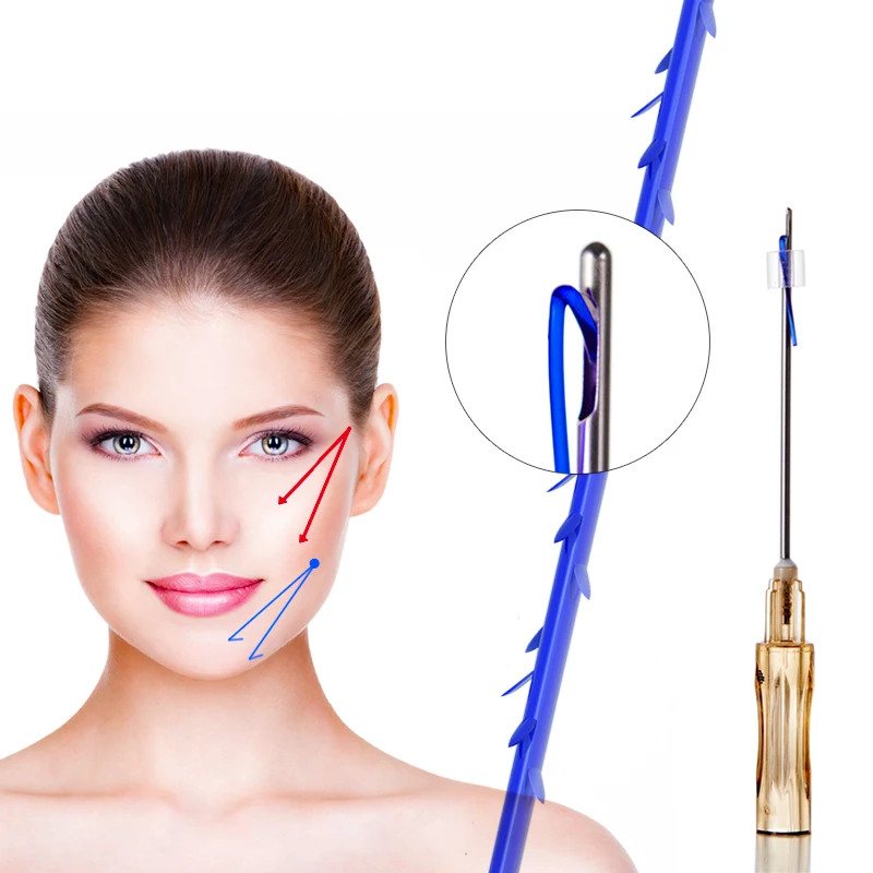 Wholesale beauty facelifting threads cog 4d barbed blunt pdo thread lift korea for lifting face and body