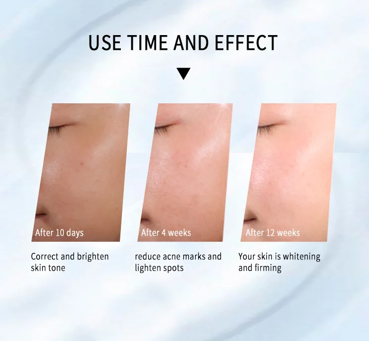 Private Label High Quality Moisturizing Anti Acne Face Niacinamide Skin Whitening Serum