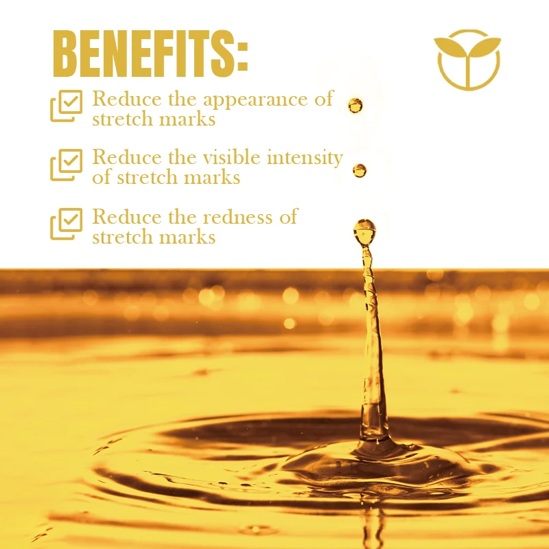 Wholesale Best Natural Stretch Marks Oil Skincare Moisturize Removal Stretch Mark Body Oil For Pregnant Scars Stretch Marks