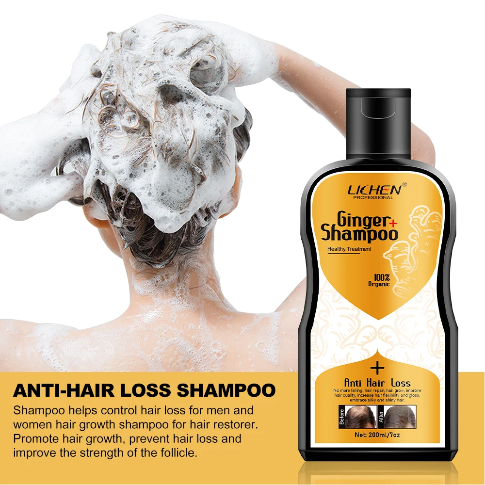 100% herbal plant ginseng anti-dandruff shampoo hair falling ginger shampoo hair loss