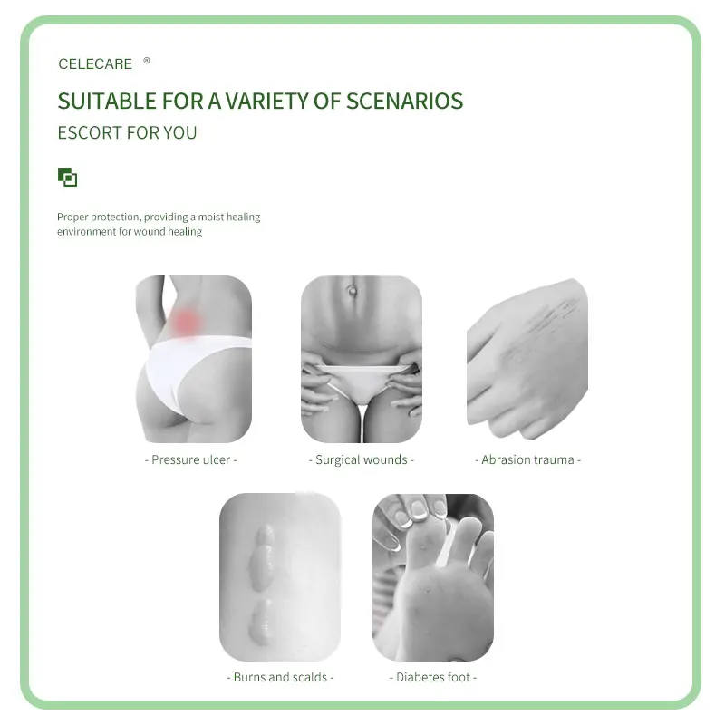 Hydrogel Adhesive Wound Dressing Disposable Heal Foam Dressing