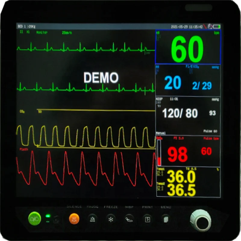 15 дюймов медицинское оборудование заводская цена 6 параметров Ветеринарный монитор пациента опция ETCO2